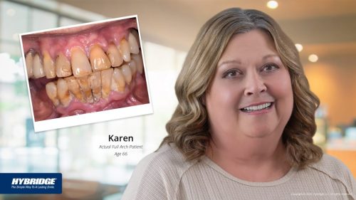 BL_Before-After_Smile_Gallery_Karen_color