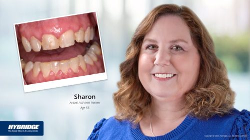 BL_Before-After_Smile_Gallery_Sharon_color