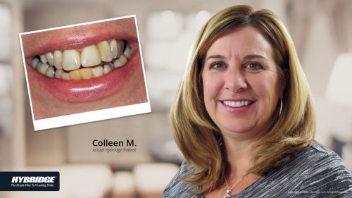 before-after_smile_gallery_w-bkgds_colleen-m_1920x1080_3