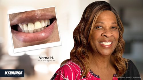 before-after_smile_gallery_w-bkgds_verna_1920x1080